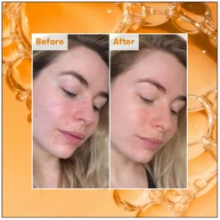 REN Clean Skincare Ready Steady Glow Daily AHA Tonic 250ml -Cosmetic Products Store 11653879 5814894570495782