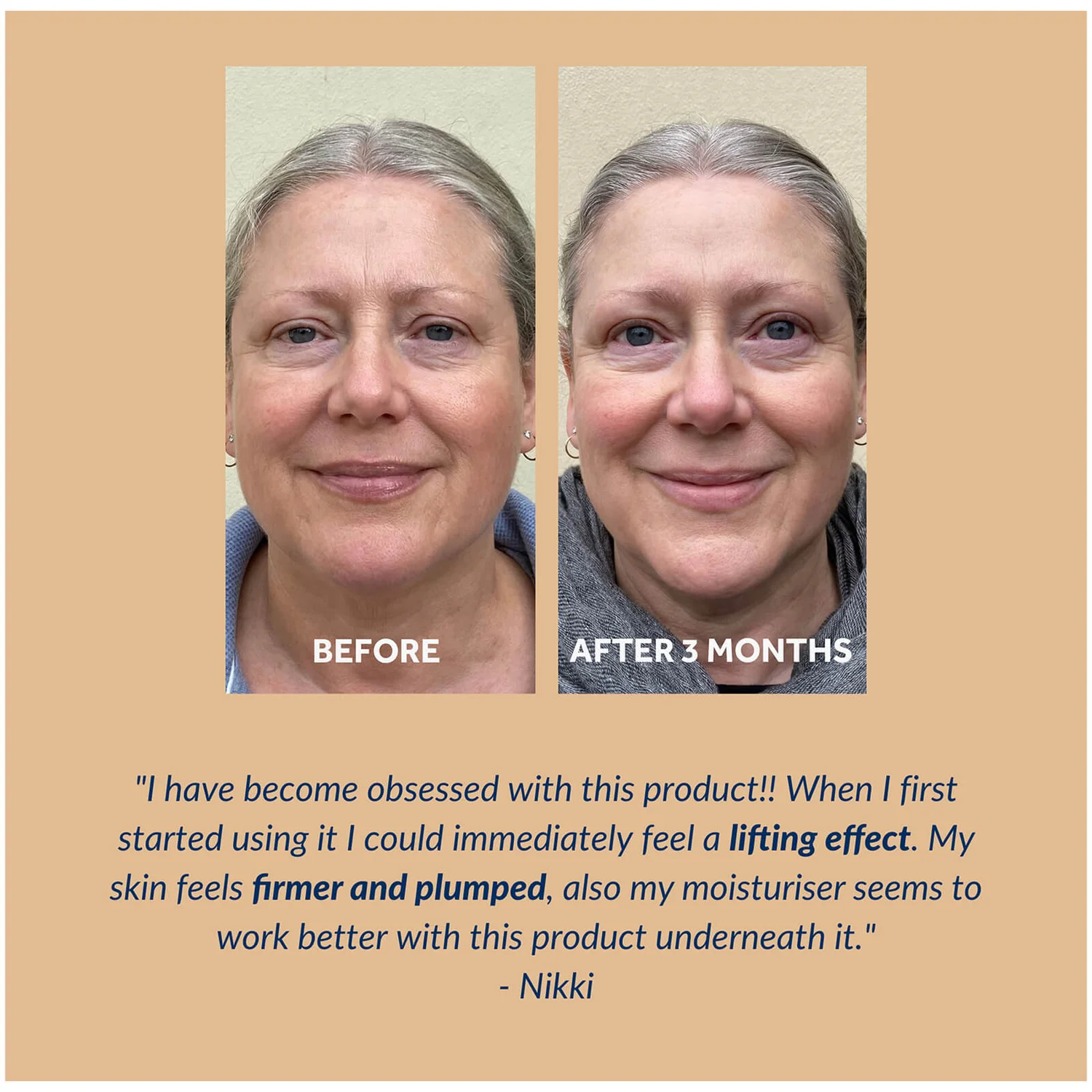 Gallinée Probiotic Youthful Serum 30ml 8 Gallinée Probiotic Youthful Serum 30ml - Image 6