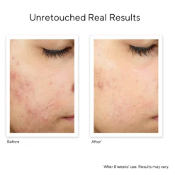 Murad InvisiScar Resurfacing Treatment 15ml -Cosmetic Products Store 12245717 3564702781757348