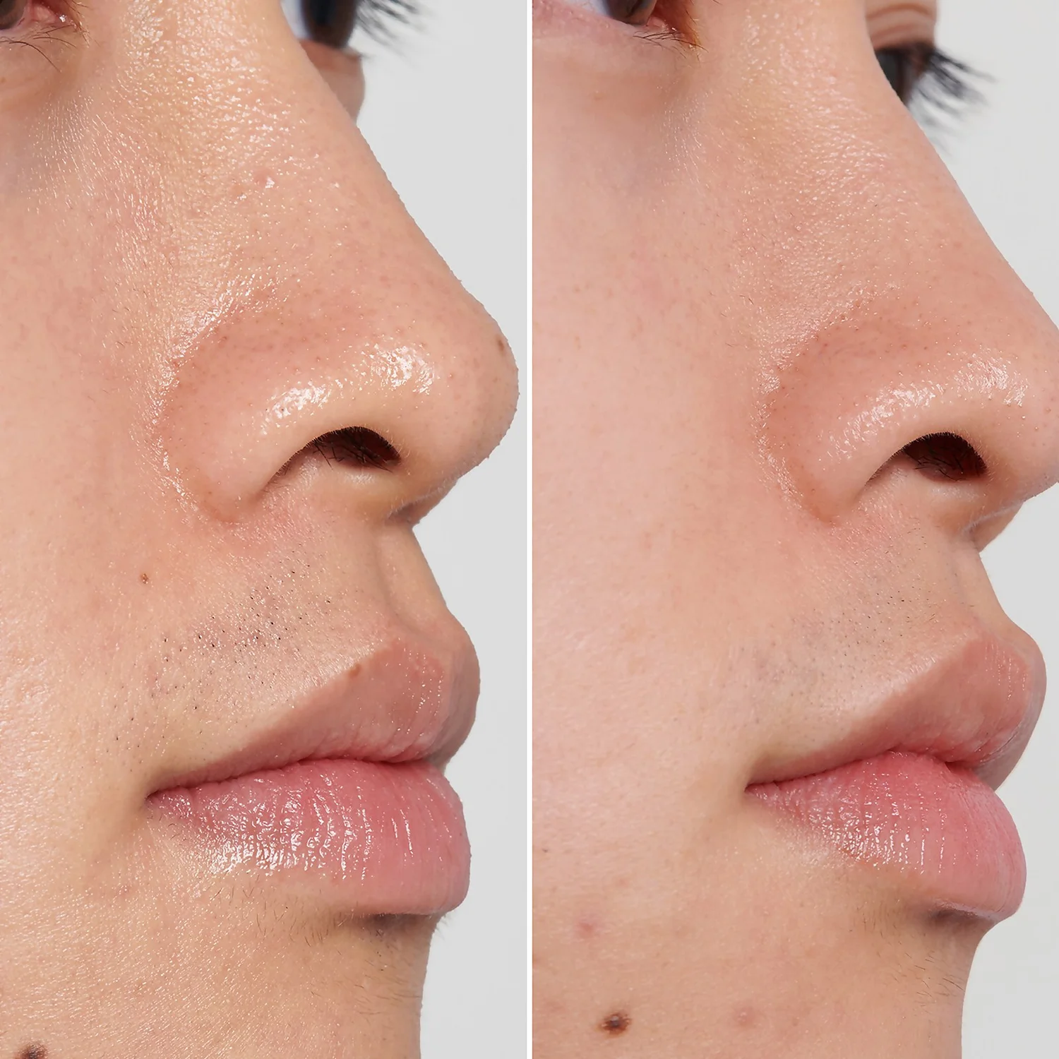 The INKEY List PHA Toner 100ml 6 The INKEY List PHA Toner 100ml - Image 4