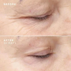 BIOEFFECT 30 Day Treatment 3 X 5ml 14 BIOEFFECT 30 Day Treatment 3 X 5ml -Cosmetic Products Store 12434372 7184821040614282