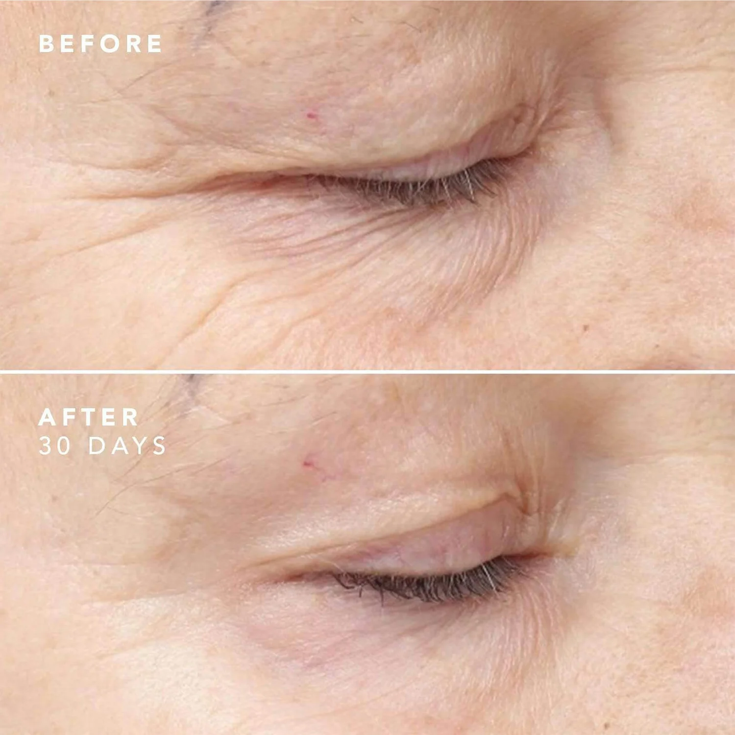 BIOEFFECT 30 Day Treatment 3 X 5ml 8 BIOEFFECT 30 Day Treatment 3 X 5ml - Image 6