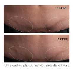 StriVectin SD Advanced PLUS Intensive Moisturising Concentrate 118ml -Cosmetic Products Store 12528621 1864886106082638